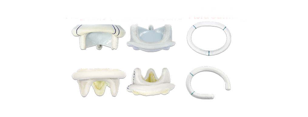 心脏瓣膜置换与修复治疗